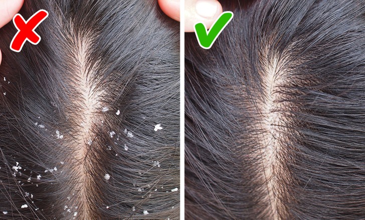 Bạn có thường xuyên bị rụng tóc không. Đây là 6 cách giúp bạn mọc lại tóc một cách nhanh và tự nhiên nhất - Ảnh 2